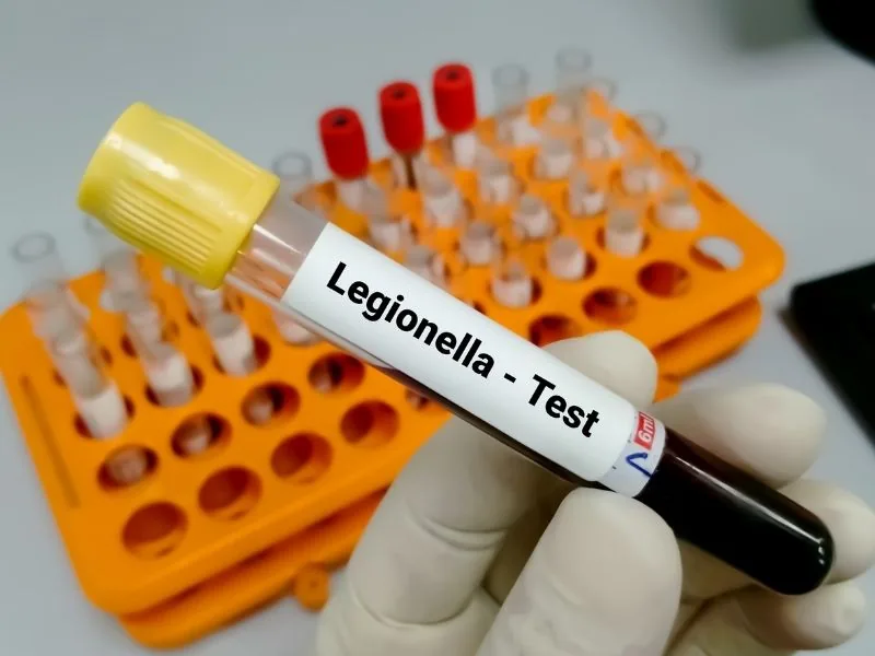 Legionella water sample test — Legionella prevention and control in Marbella by MAPECO
